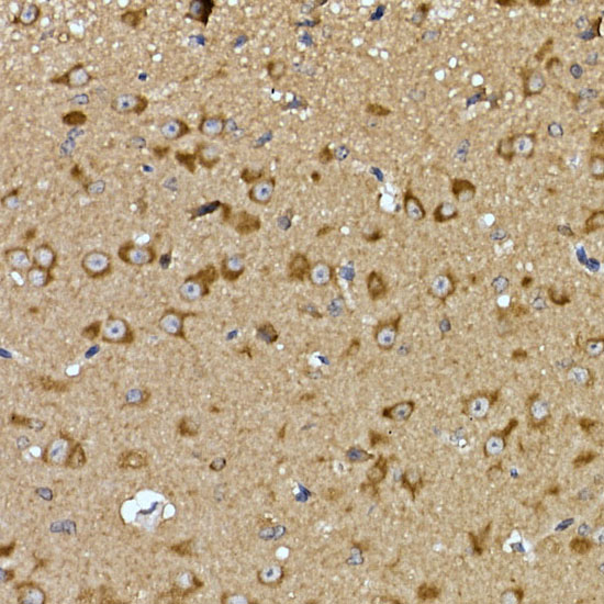 Immunohistochemistry of paraffin-embedded mouse brain using PRPSAP2 Polyclonal Antibody at dilution of 1:100 (40x lens).Perform high pressure antigen retrieval with 10 mM citrate buffer pH 6.0 before commencing with IHC staining protocol.