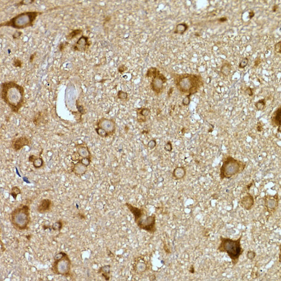 Immunohistochemistry of paraffin-embedded mouse spinal cord using PRPSAP2 Polyclonal Antibody at dilution of 1:100 (40x lens).Perform high pressure antigen retrieval with 10 mM citrate buffer pH 6.0 before commencing with IHC staining protocol.