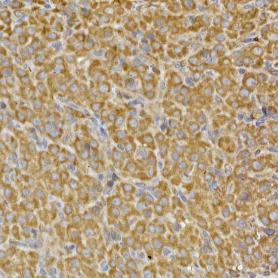 Immunohistochemistry of paraffin-embedded rat ovary using PRPSAP2 Polyclonal Antibody at dilution of 1:100 (40x lens).Perform high pressure antigen retrieval with 10 mM citrate buffer pH 6.0 before commencing with IHC staining protocol.