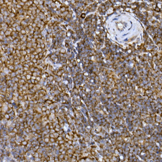 Immunohistochemistry of paraffin-embedded rat spleen using PRPSAP2 Polyclonal Antibody at dilution of 1:100 (40x lens).Perform high pressure antigen retrieval with 10 mM citrate buffer pH 6.0 before commencing with IHC staining protocol.