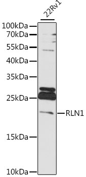 Western blot analysis of extracts of 22Rv1 cells using RLN1 Polyclonal Antibody at 1:1000 dilution.