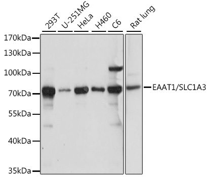 Western blot analysis of extracts of various cell lines using EAAT1/EAAT1/SLC1A3 Polyclonal Antibody at 1:1000 dilution.