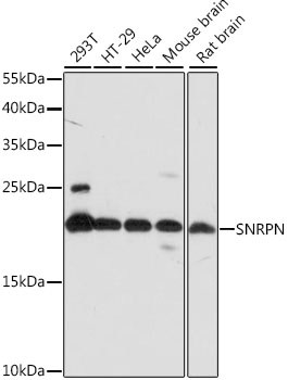 Western blot analysis of extracts of various cell lines using SNRPN Polyclonal Antibody at 1:1000 dilution.