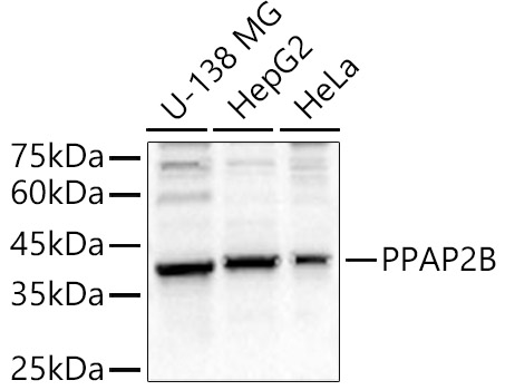 Western blot analysis of various lysates using PPAP2B Polyclonal Antibody at 1:1000 dilution.