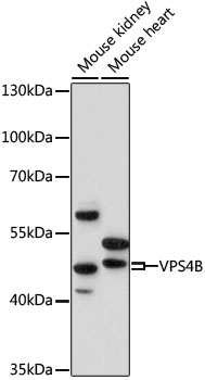 Western blot analysis of extracts of various cell lines using VPS4B Polyclonal Antibody at 1:1000 dilution.