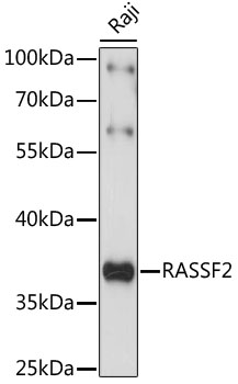 Western blot analysis of extracts of Raji cells using RASSF2 Polyclonal Antibody at 1:1000 dilution.