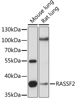 Western blot analysis of extracts of various cell lines using RASSF2 Polyclonal Antibody at 1:1000 dilution.