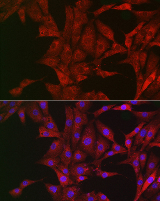 Immunofluorescence analysis of NIH/3T3 cells using Bim Polyclonal Antibody at dilution of 1:200 (40x lens). Blue: DAPI for nuclear staining.