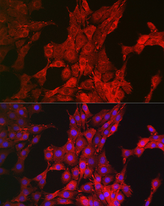 Immunofluorescence analysis of PC-12 cells using Bim Polyclonal Antibody at dilution of 1:200 (40x lens). Blue: DAPI for nuclear staining.