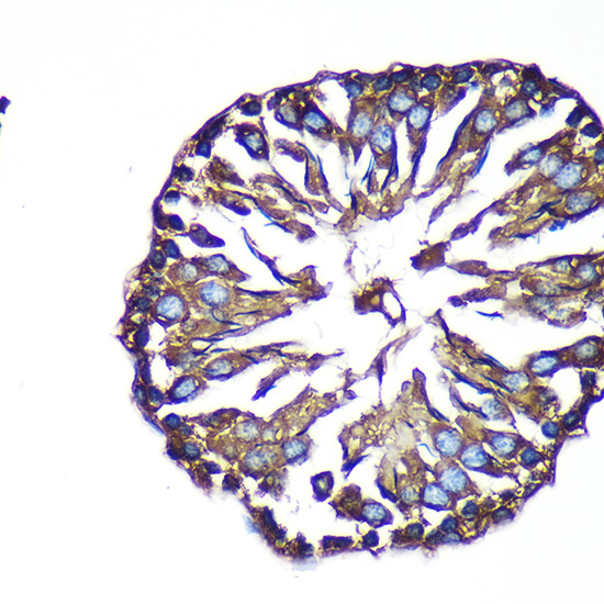 Immunohistochemistry of paraffin-embedded Rat testis using ACTR1B Polyclonal Antibody at dilution of 1:100 (40x lens).Perform microwave antigen retrieval with 10 mM PBS buffer pH 7.2 before commencing with IHC staining protocol.