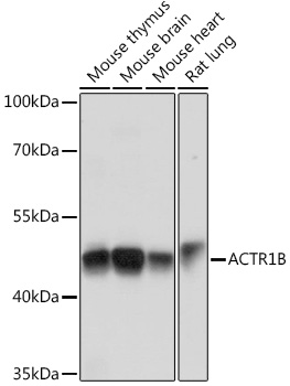 Western blot analysis of extracts of various cell lines using ACTR1B Polyclonal Antibody at1:1000 dilution.