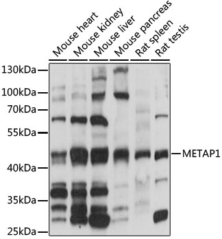 Western blot analysis of extracts of various cell lines using METAP1 Polyclonal Antibody at 1:1000 dilution.