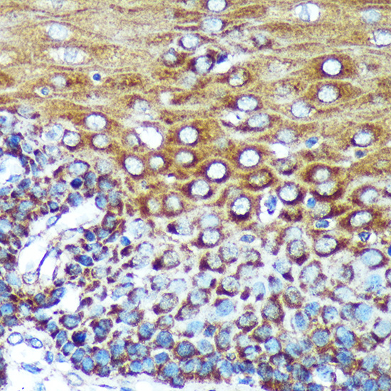 Immunohistochemistry of paraffin-embedded Human esophageal using SPECC1L Polyclonal Antibody at dilution of 1:100 (40x lens).Perform microwave antigen retrieval with 10 mM PBS buffer pH 7.2 before commencing with IHC staining protocol.