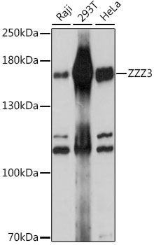 Western blot analysis of extracts of various cell lines using ZZZ3 Polyclonal Antibody at 1:1000 dilution.