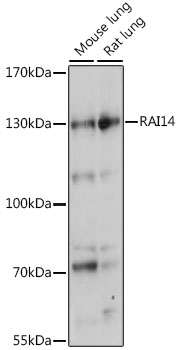 Western blot analysis of extracts of various cell lines using RAI14 Polyclonal Antibody at 1:1000 dilution.