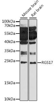 Western blot analysis of extracts of various cell lines using RGS17 Polyclonal Antibody at 1:1000 dilution.