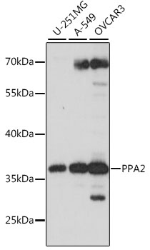 Western blot analysis of extracts of various cell lines using PPA2 Polyclonal Antibody at 1:1000 dilution.