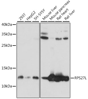 Western blot analysis of extracts of various cell lines using RPS27L Polyclonal Antibody at 1:1000 dilution.