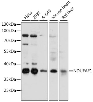 Western blot analysis of extracts of various cell lines using NDUFAF1 Polyclonal Antibody at 1:1000 dilution.