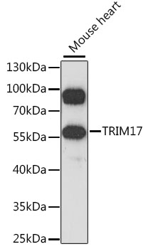 Western blot analysis of extracts of mouse heart using TRIM17 Polyclonal Antibody at 1:1000 dilution.