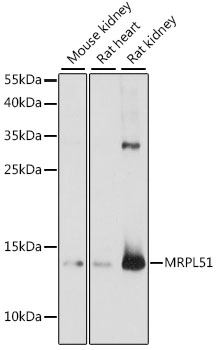 Western blot analysis of extracts of various cell lines using MRPL51 Polyclonal Antibody at 1:1000 dilution.