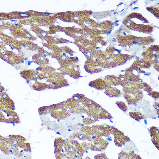 Immunohistochemistry of paraffin-embedded Rat heart using TIMMDC1 Polyclonal Antibody at dilution of 1:100 (40x lens).Perform microwave antigen retrieval with 10 mM PBS buffer pH 7.2 before commencing with IHC staining protocol.