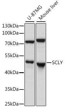 Western blot analysis of extracts of various cell lines using SCLY Polyclonal Antibody at 1:1000 dilution.