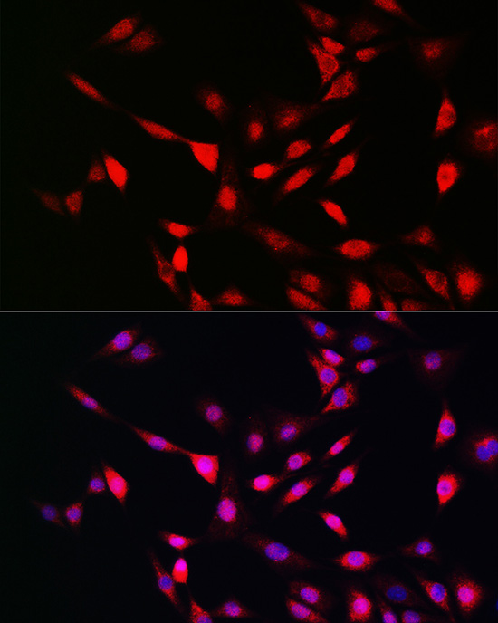 Immunofluorescence analysis of NIH/3T3 cells using UFM1 Polyclonal Antibody at dilution of 1:100 (40x lens). Blue: DAPI for nuclear staining.