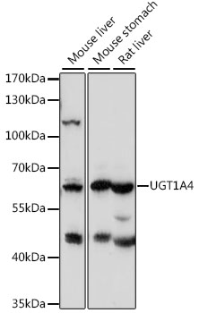 Western blot analysis of extracts of various cell lines using UGT1A4 Polyclonal Antibody at 1:1000 dilution.