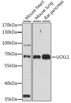 Western blot analysis of extracts of various cell lines using UCKL1 Polyclonal Antibody at 1:1000 dilution.