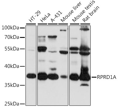 Western blot analysis of extracts of various cell lines using RPRD1A Polyclonal Antibody at 1:1000 dilution.