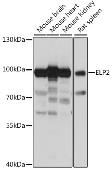 Western blot analysis of extracts of various cell lines using ELP2 Polyclonal Antibody at 1:1000 dilution.