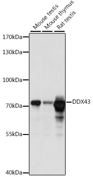 Western blot analysis of extracts of various cell lines using DDX43 Polyclonal Antibody at 1:1000 dilution.