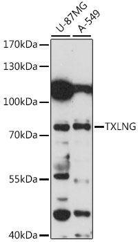 Western blot analysis of extracts of various cell lines using TXLNG Polyclonal Antibody at 1:1000 dilution.