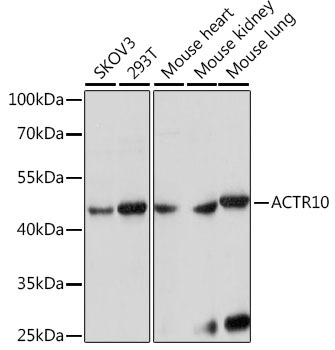 Western blot analysis of extracts of various cell lines using ACTR10 Polyclonal Antibody at 1:1000 dilution.