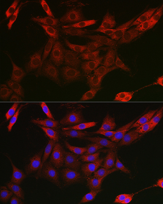 Immunofluorescence analysis of PC-12 cells using UBQLN4 Polyclonal Antibody at dilution of 1:50 (40x lens). Blue: DAPI for nuclear staining.