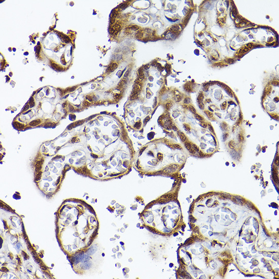 Immunohistochemistry of paraffin-embedded human placenta using UBQLN4 Polyclonal Antibody at dilution of 1:100 (40x lens).Perform high pressure antigen retrieval with 10 mM citrate buffer pH 6.0 before commencing with IHC staining protocol.