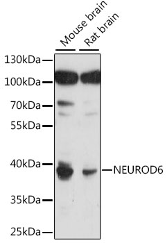 Western blot analysis of extracts of various cell lines using NEUROD6 Polyclonal Antibody at 1:1000 dilution.