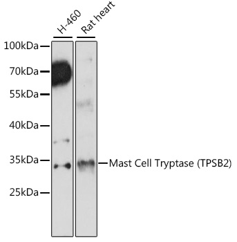 Western blot analysis of extracts of various cell lines using Mast Cell Tryptase Polyclonal Antibody at1:1000 dilution.