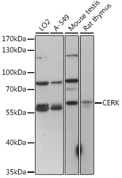 Western blot analysis of extracts of various cell lines using CERK Polyclonal Antibody at 1:1000 dilution.