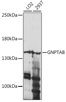 Western blot analysis of extracts of various cell lines using GNPTAB Polyclonal Antibody at 1:1000 dilution.