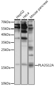 Western blot analysis of extracts of various cell lines using PLA2G12A Polyclonal Antibody at 1:1000 dilution.