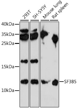 Western blot analysis of extracts of various cell lines using SF3B5 Polyclonal Antibody at 1:1000 dilution.