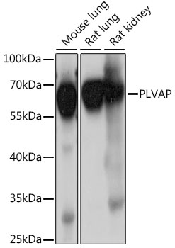 Western blot analysis of extracts of various cell lines using PLVAP Polyclonal Antibody at 1:1000 dilution.