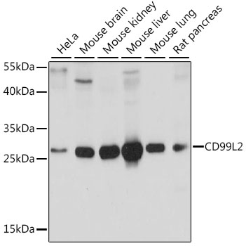 Western blot analysis of extracts of various cell lines using CD99L2 Polyclonal Antibody at 1:1000 dilution.