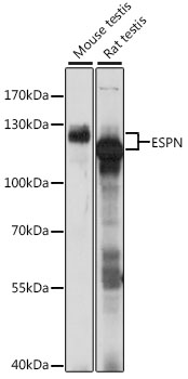 Western blot analysis of extracts of various cell lines using ESPN Polyclonal Antibody at 1:1000 dilution.