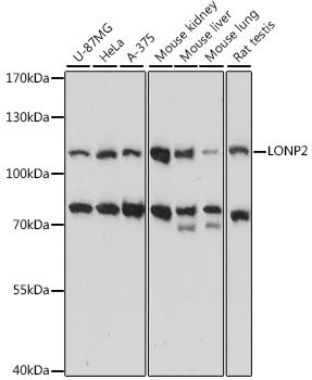 Western blot analysis of extracts of various cell lines using LONP2 Polyclonal Antibody at 1:1000 dilution.