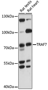 Western blot analysis of extracts of various cell lines using TRAF7 Polyclonal Antibody at 1000 dilution.