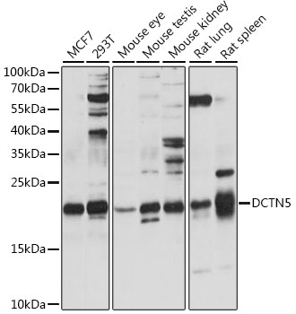 Western blot analysis of extracts of various cell lines using DCTN5 Polyclonal Antibody at 1:1000 dilution.