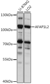 Western blot analysis of extracts of various cell lines using AFAP1L2 Polyclonal Antibody at 1:1000 dilution.